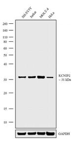 KChIP2 Antibody in Western Blot (WB)