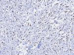 TRPS1 (Transcriptional repressor GATA binding 1) Antibody in Immunohistochemistry (Paraffin) (IHC (P))