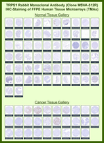 TRPS1 (Transcriptional repressor GATA binding 1) Recombinant Rabbit Monoclonal Antibody (MSVA-512R)