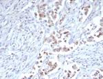 TRPS1 (Transcriptional repressor GATA binding 1) Recombinant Rabbit Monoclonal Antibody (TRPS1/7912R)