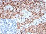 TRPS1 (Transcriptional repressor GATA binding 1) Antibody in Immunohistochemistry (Paraffin) (IHC (P))