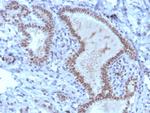 TRPS1 (Transcriptional repressor GATA binding 1) Recombinant Rabbit Monoclonal Antibody (TRPS1/8008R)