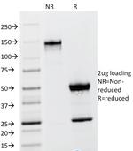 Thyroid Stimulating Hormone, beta (TSH beta) Antibody in SDS-PAGE (SDS-PAGE)