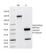 Thyroid Stimulating Hormone, beta (TSH beta) (Pituitary Marker) Antibody in SDS-PAGE (SDS-PAGE)