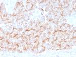 Tubulin-alpha (Microtubule Marker) Monoclonal Antibody (TUBA/3038)