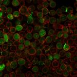 Thymidylate Synthase Recombinant Mouse Monoclonal Antibody (rTYMS, 1884)