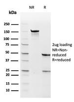 Thymidylate Synthase Antibody in SDS-PAGE (SDS-PAGE)