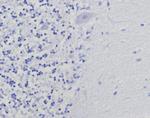 Thymidylate Synthase (5-FU Resistance Marker) Recombinant Rabbit Monoclonal Antibody (TYMS/9091R)
