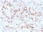 Tyrosinase Recombinant Mouse Monoclonal Antibody (rOCA1, 812)