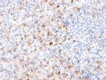 Tyrosinase Recombinant Rabbit Monoclonal Antibody (TYR, 2024R)
