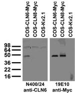 CLN6 Monoclonal Antibody (N400/24)