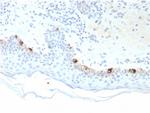 Tyrosinase-Related Protein-1 (TYRP-1) (Melanoma Marker) Monoclonal Antibody (TYRP1/3281)