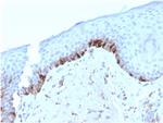 Tyrosinase-Related Protein-1 (TYRP-1) Monoclonal Antibody (TYRP1, 3282)