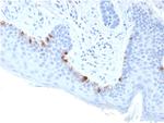 Tyrosinase-Related Protein-1 (TYRP-1) (Melanoma Marker) Monoclonal Antibody (TYRP1/3283)