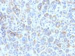 Tyrosinase-Related Protein-1 (TYRP-1) (Melanoma Marker) Monoclonal Antibody (TYRP1/807)