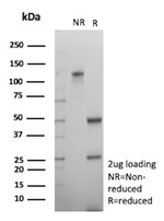 Tyrosinase-Related Protein-1 (TYRP-1) (Melanoma Marker) Antibody in SDS-PAGE (SDS-PAGE)