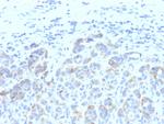 Tyrosinase-Related Protein-1 (TYRP-1) (Melanoma Marker) Monoclonal Antibody (SPM611)