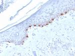 Tyrosinase-Related Protein-1 (TYRP-1) (Melanoma Marker) Monoclonal Antibody (TYRP1/1986)