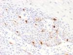 Tyrosinase-Related Protein-1 (TYRP-1) (Melanoma Marker) Recombinant Rabbit Monoclonal Antibody (TYRP1/2340R)