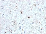 Ubiquitin Antibody in Immunohistochemistry (Paraffin) (IHC (P))