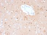 Ubiquitin (Autophagy Marker) Monoclonal Antibody (UBB/2122)