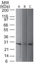 PGP9.5/UchL1 (pan-Neuronal Marker) Antibody in Western Blot (WB)