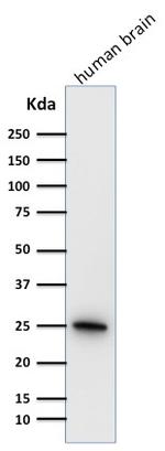 PGP9.5/UchL1 (pan-Neuronal Marker) Antibody in Western Blot (WB)