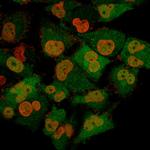 PGP9.5/UchL1 (pan-Neuronal Marker) Monoclonal Antibody (13C4)