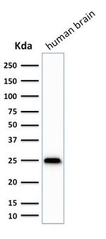 PGP9.5/UchL1 Antibody in Western Blot (WB)