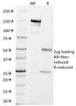 PGP9.5/UchL1 Antibody in SDS-PAGE (SDS-PAGE)