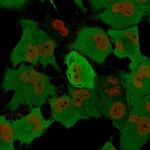 PGP9.5/UchL1 Recombinant Mouse Monoclonal Antibody (rUCHL1, 775)