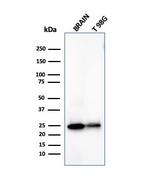 PGP9.5/UchL1 (pan-Neuronal Marker) Antibody in Western Blot (WB)