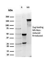 PGP9.5/UchL1 (pan-Neuronal Marker) Antibody in SDS-PAGE (SDS-PAGE)
