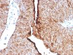 Uroplakin 1B (Urothelial Differentiation Marker) Recombinant Rabbit Monoclonal Antibody (UPK1B/8976R)