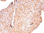 Uroplakin 1B (Urothelial Differentiation Marker) Recombinant Rabbit Monoclonal Antibody (UPK1B/9258R)