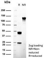 Complement Component C9 (CCC9) (Early Myocardial Infarction Marker) Antibody in SDS-PAGE (SDS-PAGE)