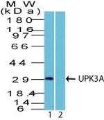 Uroplakin 3A (Bladder Carcinoma Marker) Polyclonal Antibody