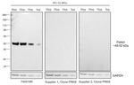 Parkin Antibody in Western Blot (WB)