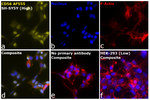 CD56 (NCAM) Antibody