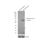 ROR gamma (t) Antibody