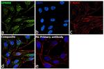 GPNMB Recombinant Mouse Monoclonal Antibody (HOST5DS)