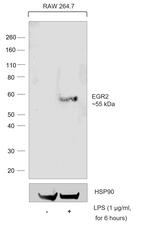 EGR2 Recombinant Rat Monoclonal Antibody (erongr2)
