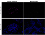 Somatostatin Antibody