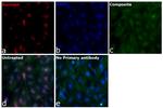 Survivin Recombinant Mouse Monoclonal Antibody (STLALYV)