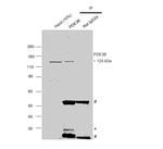 PDE3B Antibody in Immunoprecipitation (IP)