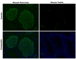 Insulin Antibody