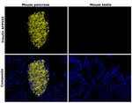 Insulin Antibody