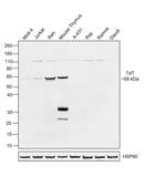 TdT Recombinant Mouse Monoclonal Antibody (7UNA8U6)