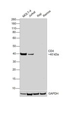 CD4 Antibody in Western Blot (WB)
