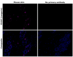 CD207 (Langerin) Antibody in Immunohistochemistry (Paraffin) (IHC (P))